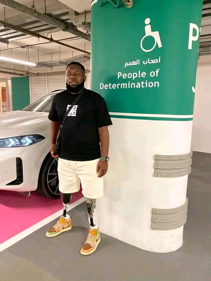 ZAMBIAN BUSINESSMAN RECOUNTS LOSING BOTH HIS LEGS IN TANZANIA ROAD CRASH