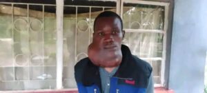 LUSAKA MAN SEEKS HELP AS TUMOR WORSENS