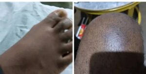 CHIPATA CENTRAL HOSPITAL FAILS TO COMMENT ON ALLEGED ASSAULT OF A PATIENT, VICTIM REPORTS TO POLICE